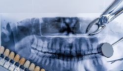 拍牙片次数多，会对身体有影响吗？