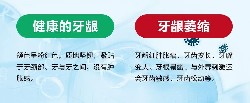 牙齿变长、牙根暴露......王昊医生提醒您注意牙龈萎缩！