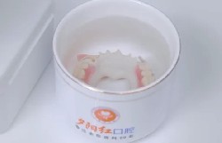 镶牙后出现食物嵌塞、牙齿疼痛，别着急！教您科学应对方法！