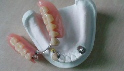 如果意外吞下假牙该怎么办？