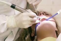 为啥补的牙老是掉？教您3招让它更牢固！