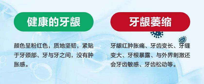 如何判断自己是否有牙龈萎缩的症状呢？其实通过对比就能发现